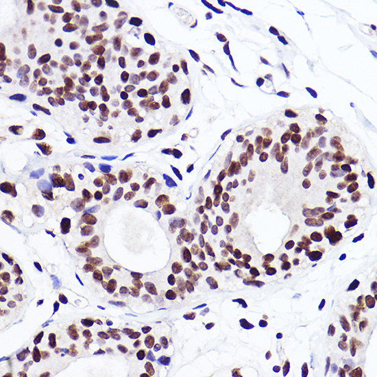 MonoMethyl-Histone H3-K18 Rabbit mAb