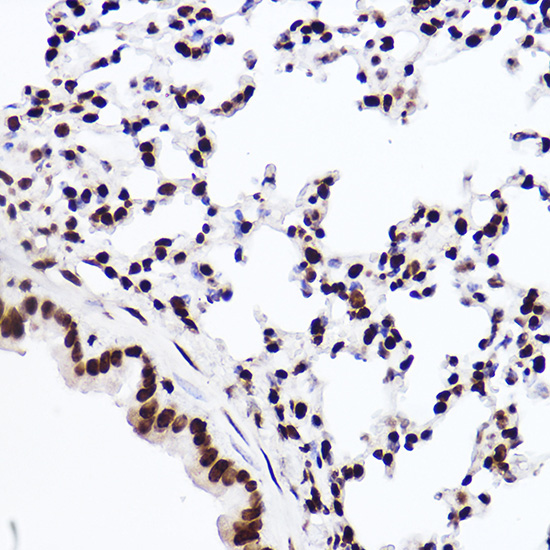 MonoMethyl-Histone H3-K18 Rabbit mAb