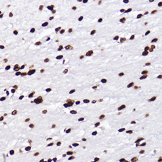 MonoMethyl-Histone H3-K18 Rabbit mAb
