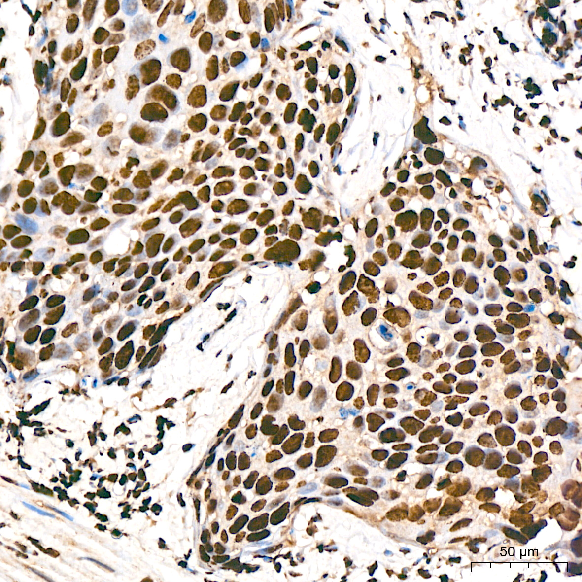 MonoMethyl-Histone H3-K9 Rabbit mAb