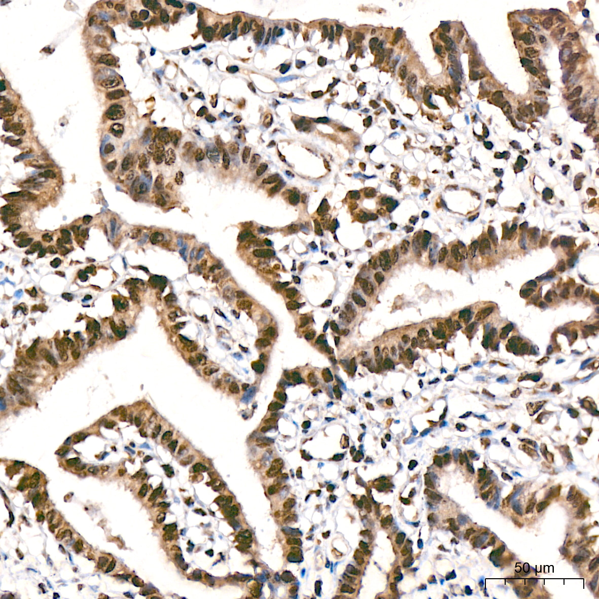 MonoMethyl-Histone H3-K9 Rabbit mAb