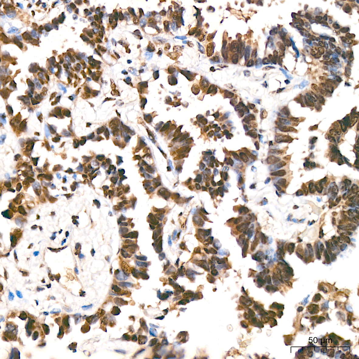 MonoMethyl-Histone H3-K9 Rabbit mAb