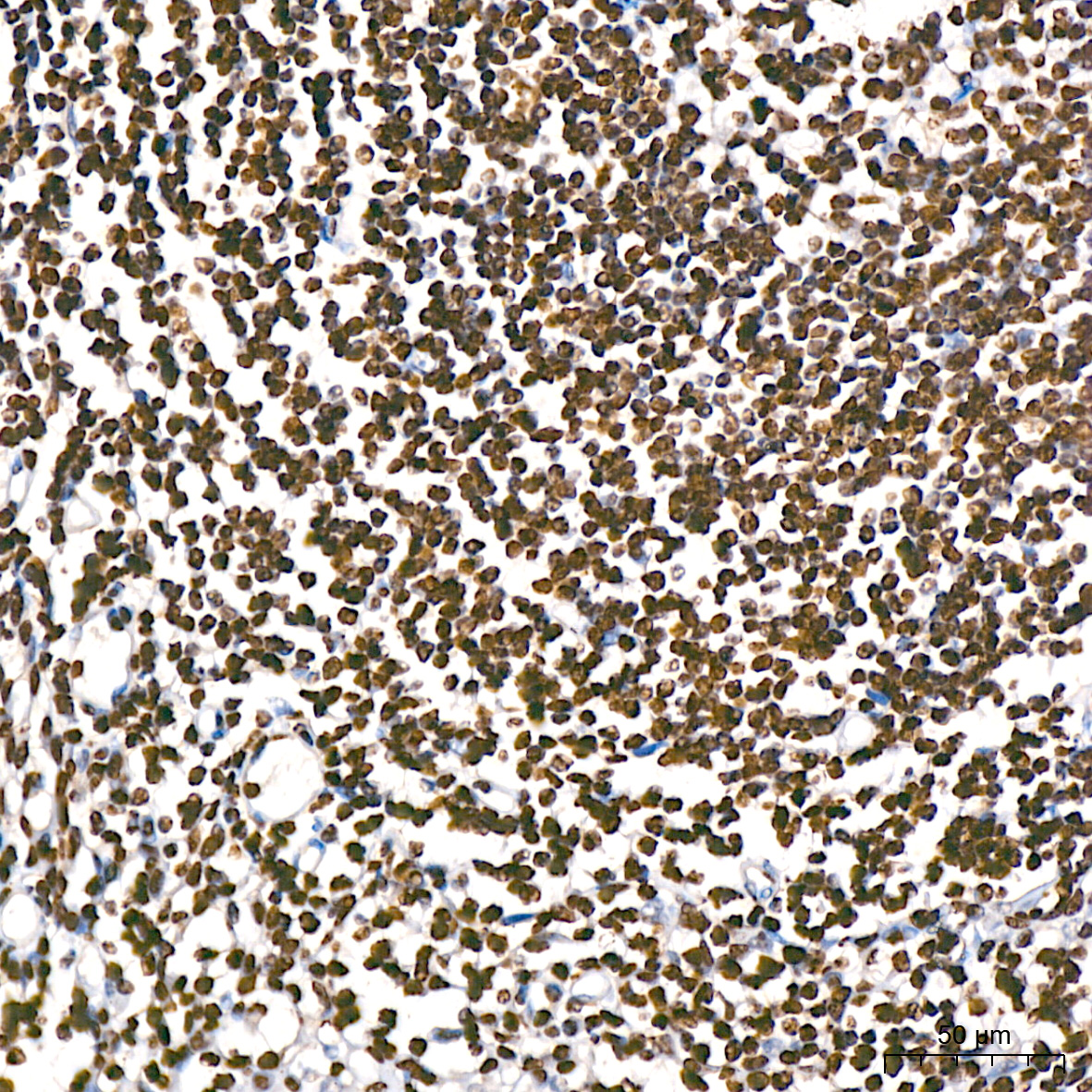 MonoMethyl-Histone H3-K9 Rabbit mAb