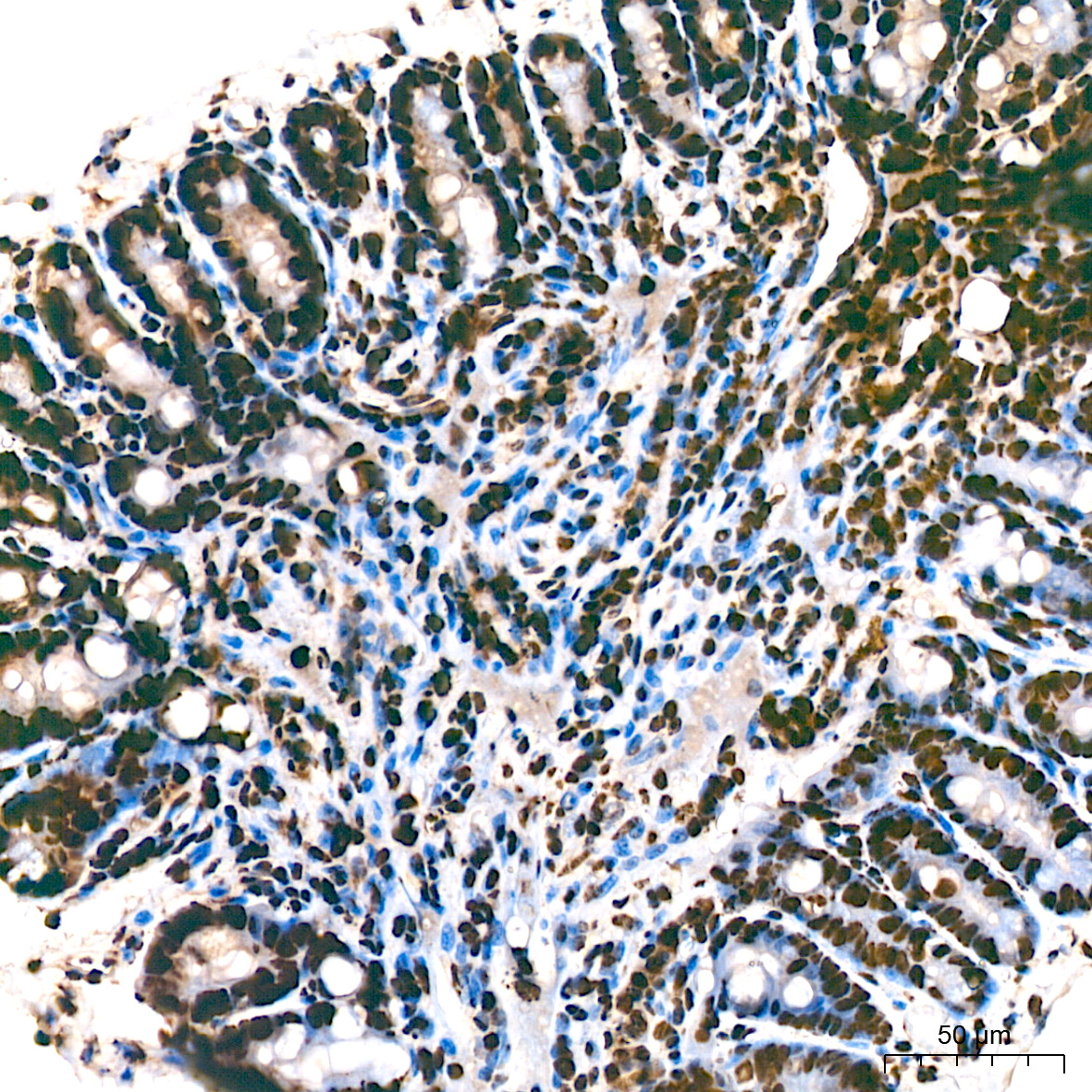 MonoMethyl-Histone H3-K9 Rabbit mAb