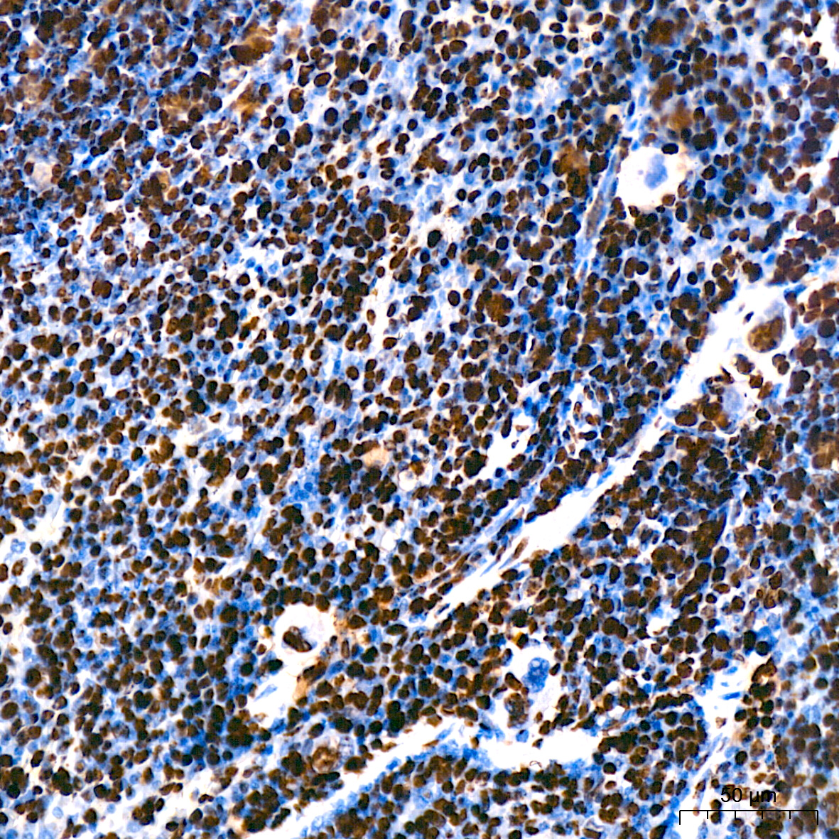 MonoMethyl-Histone H3-K9 Rabbit mAb