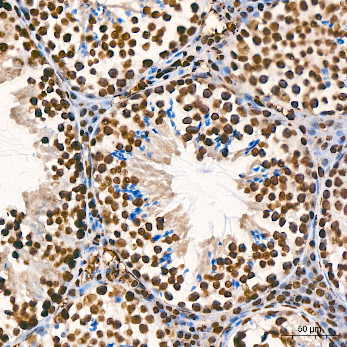 MonoMethyl-Histone H3-K9 Rabbit mAb