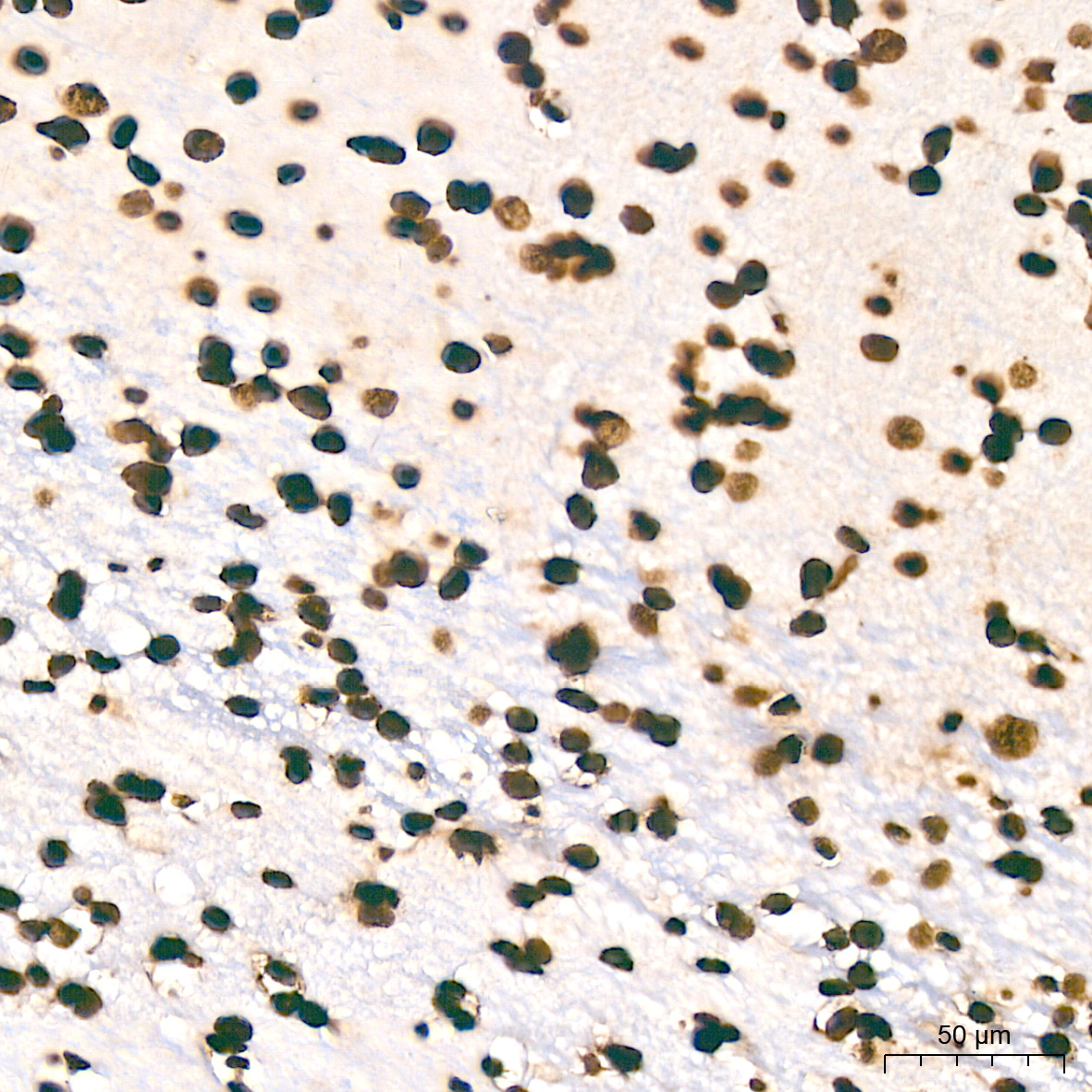 MonoMethyl-Histone H3-K9 Rabbit mAb