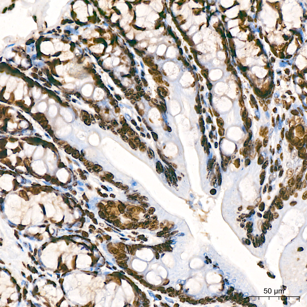 MonoMethyl-Histone H3-K9 Rabbit mAb