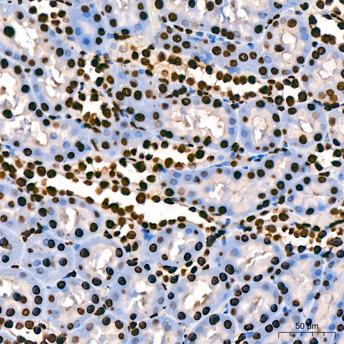 MonoMethyl-Histone H3-K9 Rabbit mAb