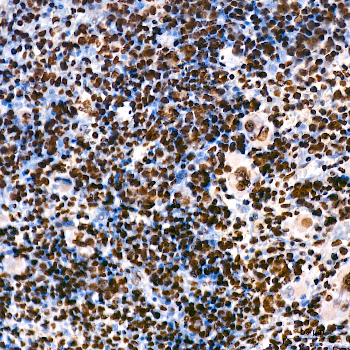 MonoMethyl-Histone H3-K9 Rabbit mAb