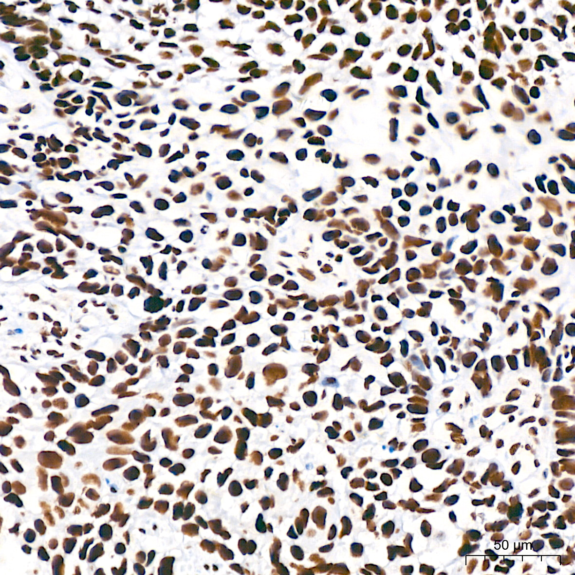 Acetyl-Histone H3-K18 Rabbit mAb
