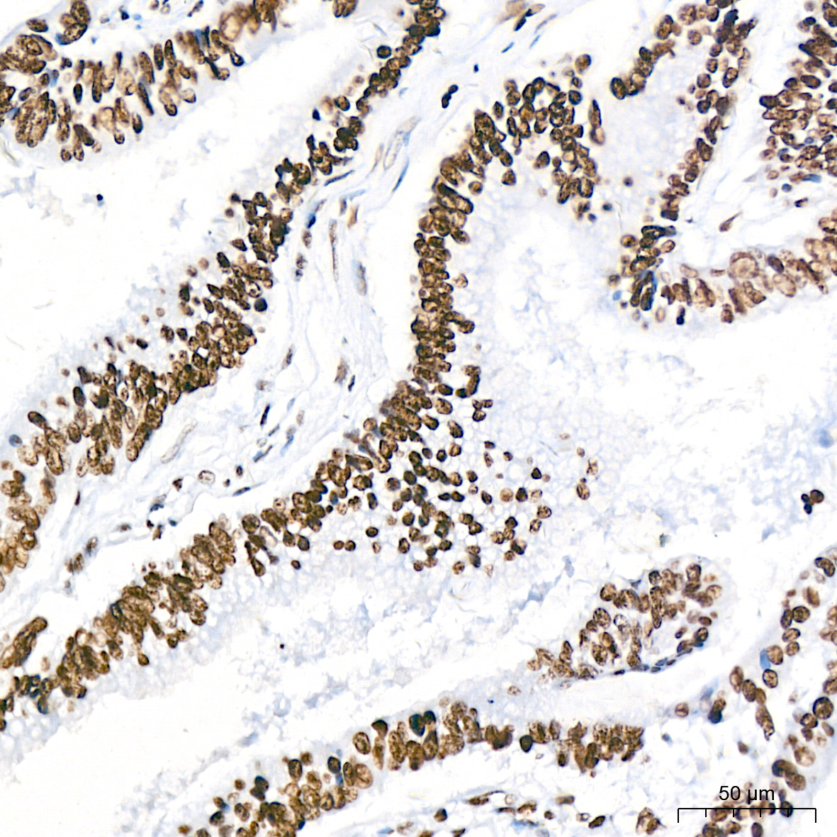 Acetyl-Histone H3-K18 Rabbit mAb