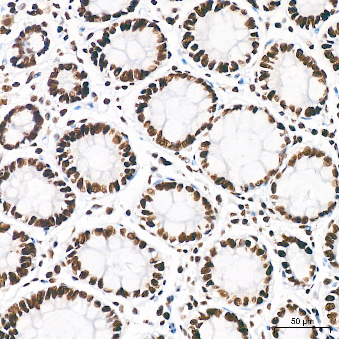 Acetyl-Histone H3-K18 Rabbit mAb