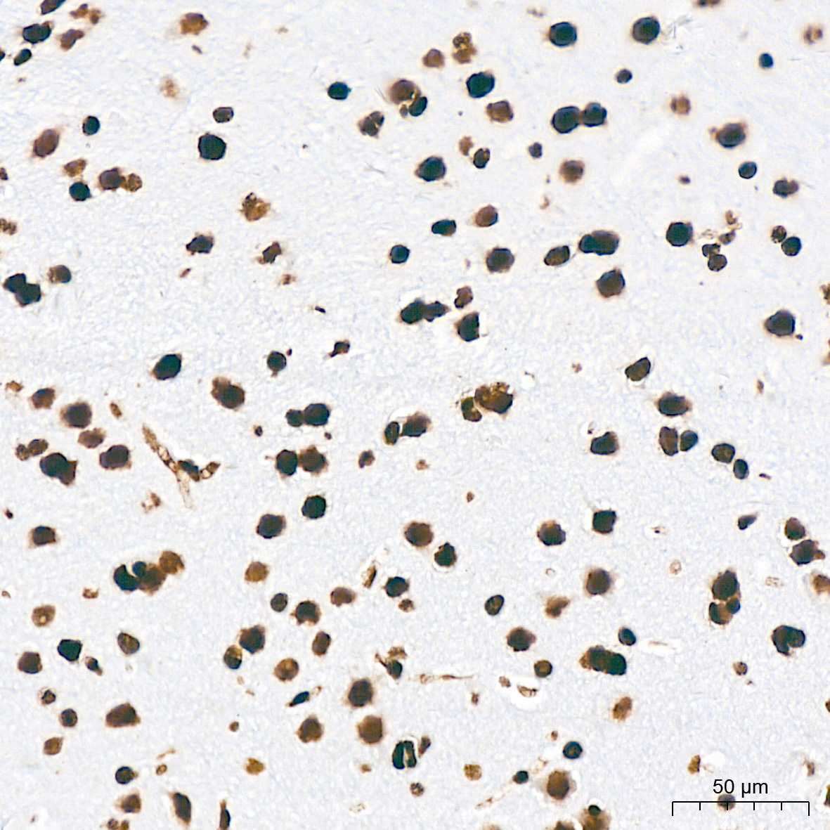 Acetyl-Histone H3-K18 Rabbit mAb