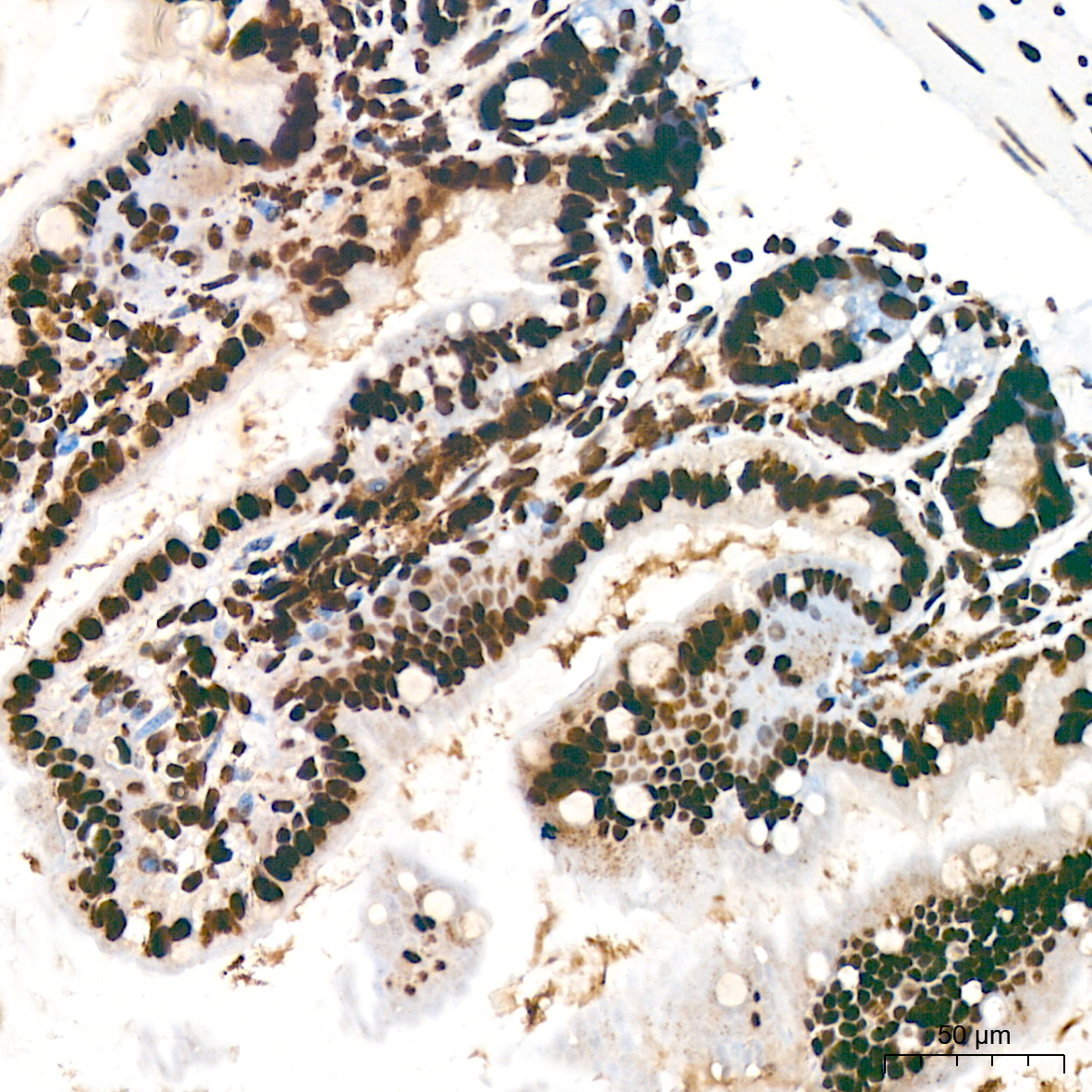 Acetyl-Histone H3-K18 Rabbit mAb