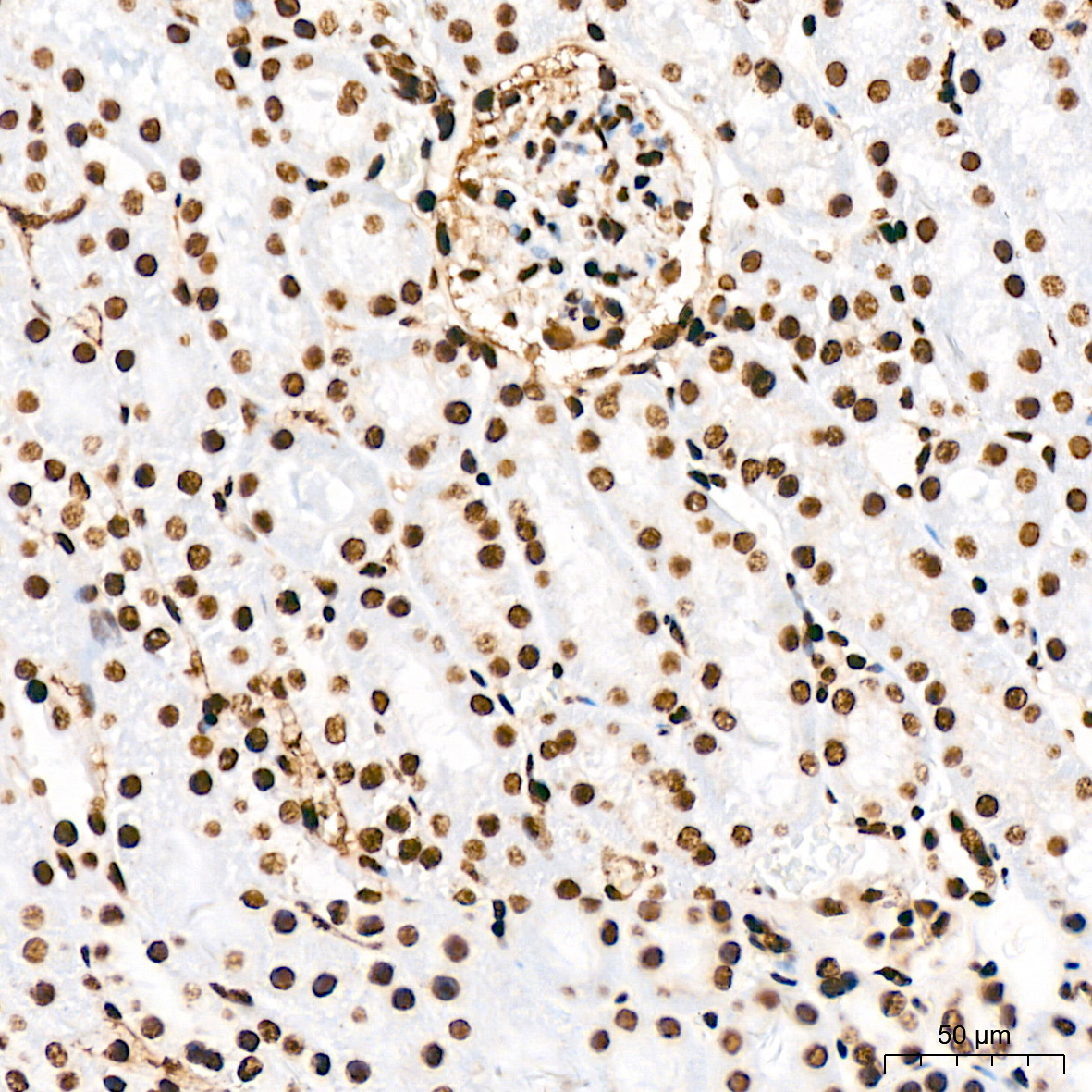 Acetyl-Histone H3-K18 Rabbit mAb
