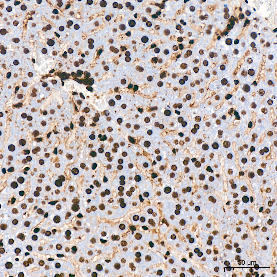 Acetyl-Histone H3-K18 Rabbit mAb