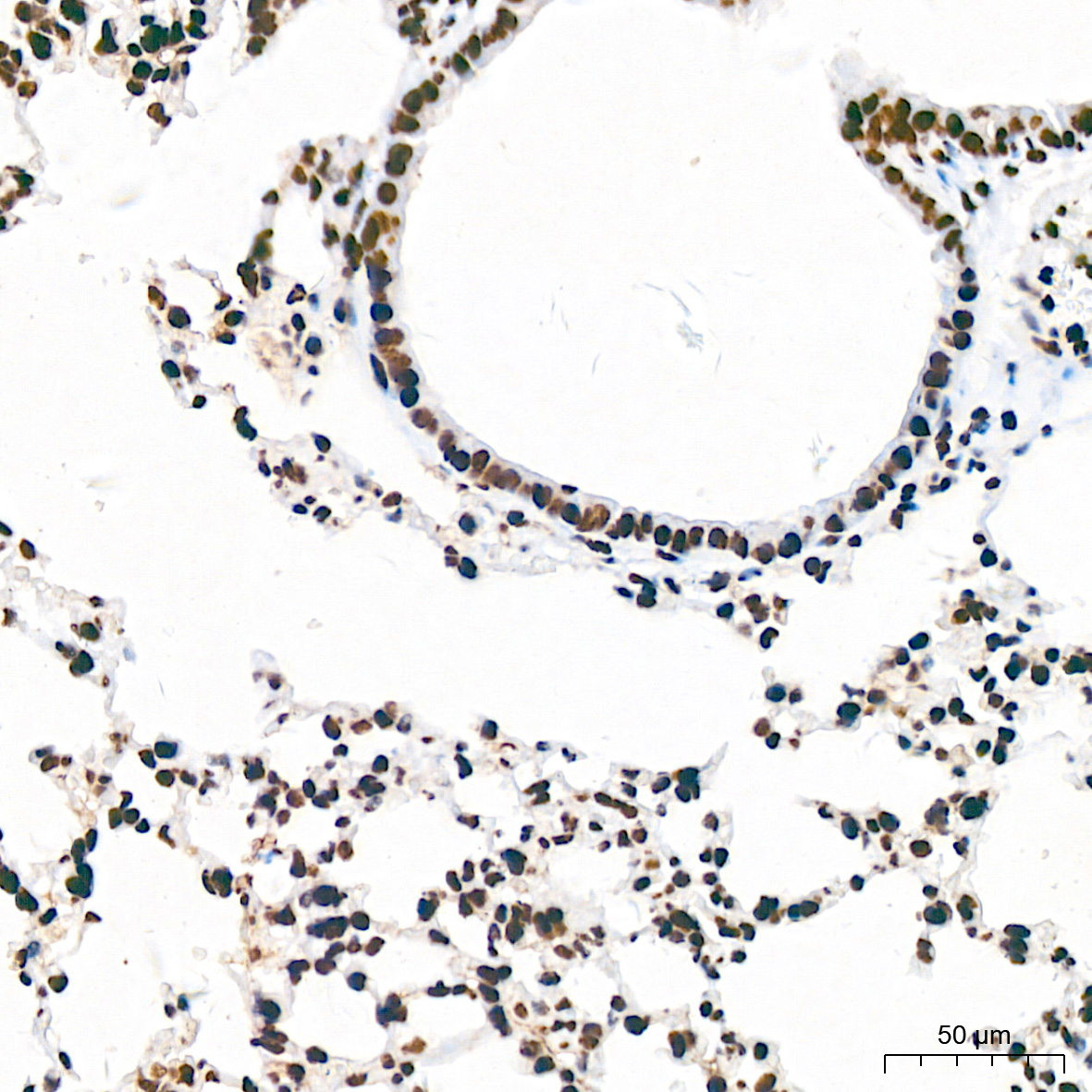 Acetyl-Histone H3-K18 Rabbit mAb