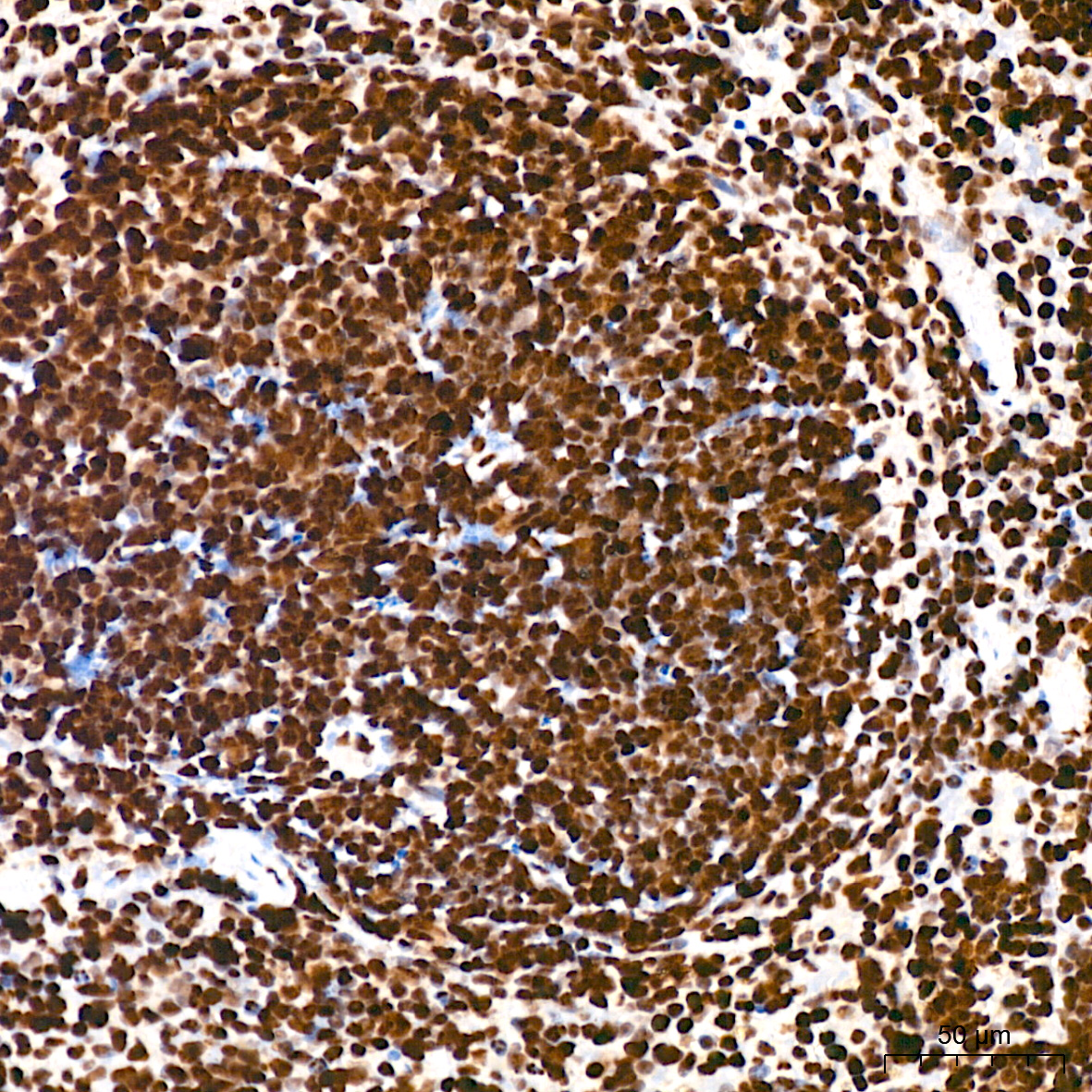 Acetyl-Histone H3-K18 Rabbit mAb