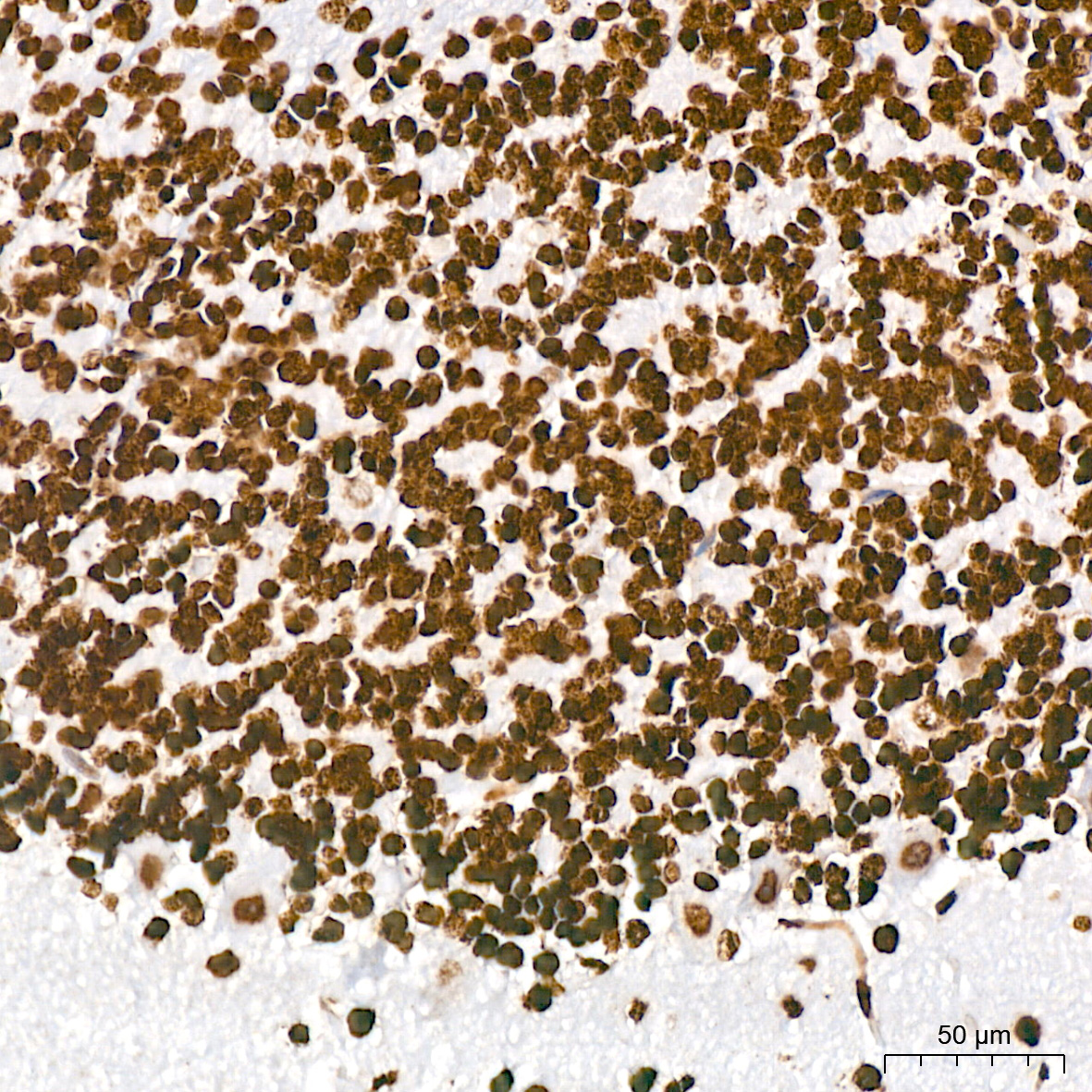 Acetyl-Histone H3-K18 Rabbit mAb