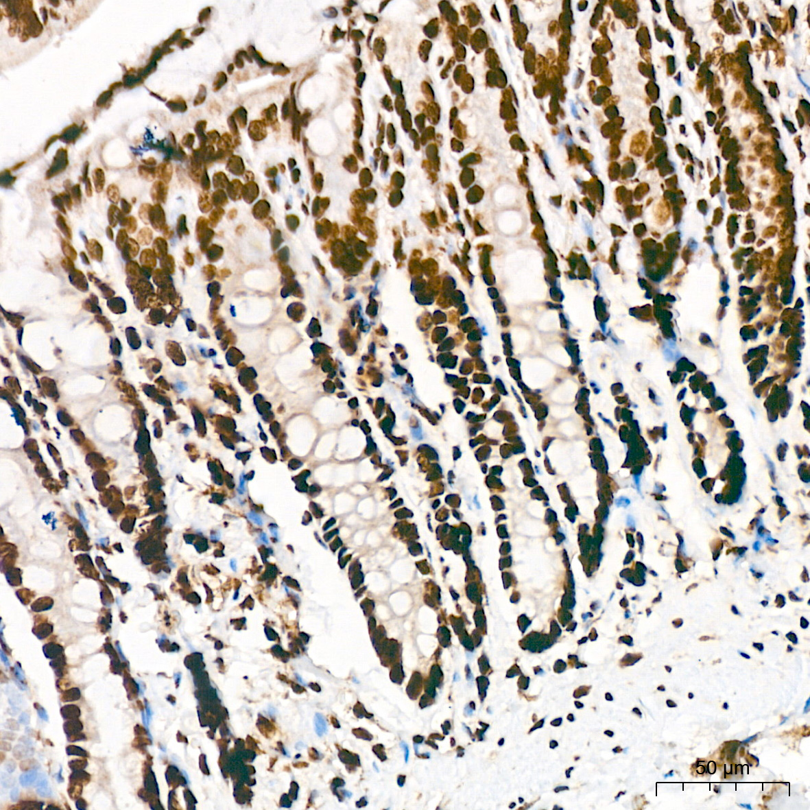 Acetyl-Histone H3-K18 Rabbit mAb