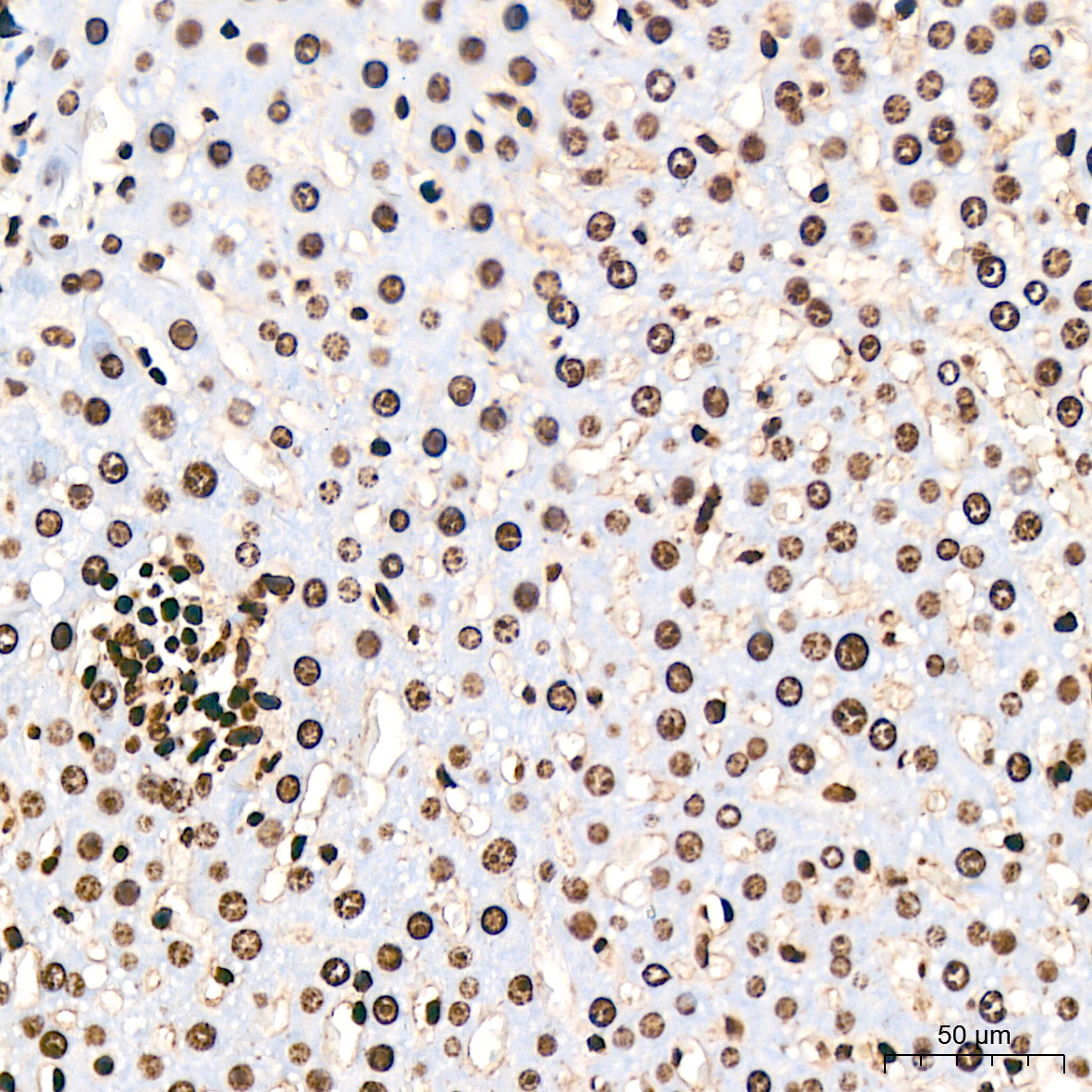 Acetyl-Histone H3-K18 Rabbit mAb