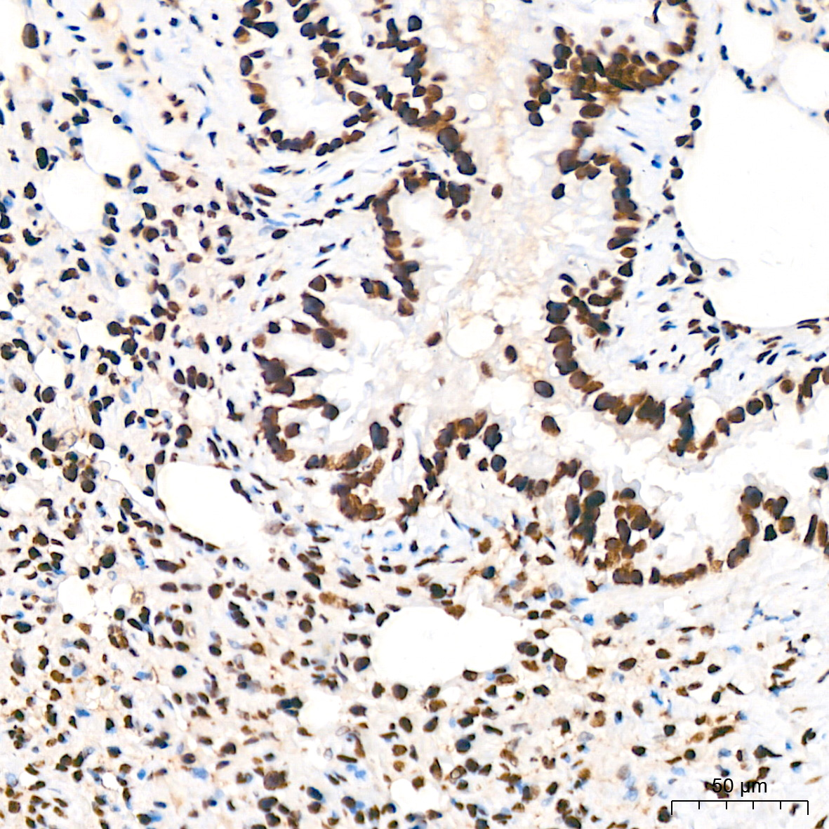 Acetyl-Histone H3-K18 Rabbit mAb