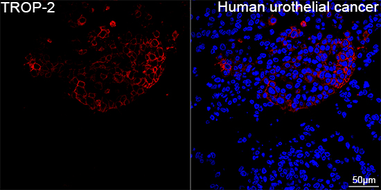 Immunofluorescence-Paraffin Embedded Fixed Tissue Sample - TROP-2 Rabbit mAb (A20824)