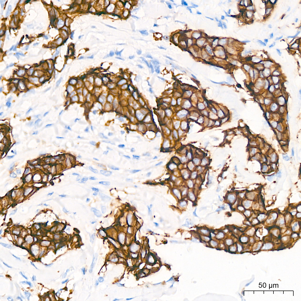 Immunohistochemistry-Paraffin Embeded Fixed Tissue Sample - TROP-2 Rabbit mAb (A20824)