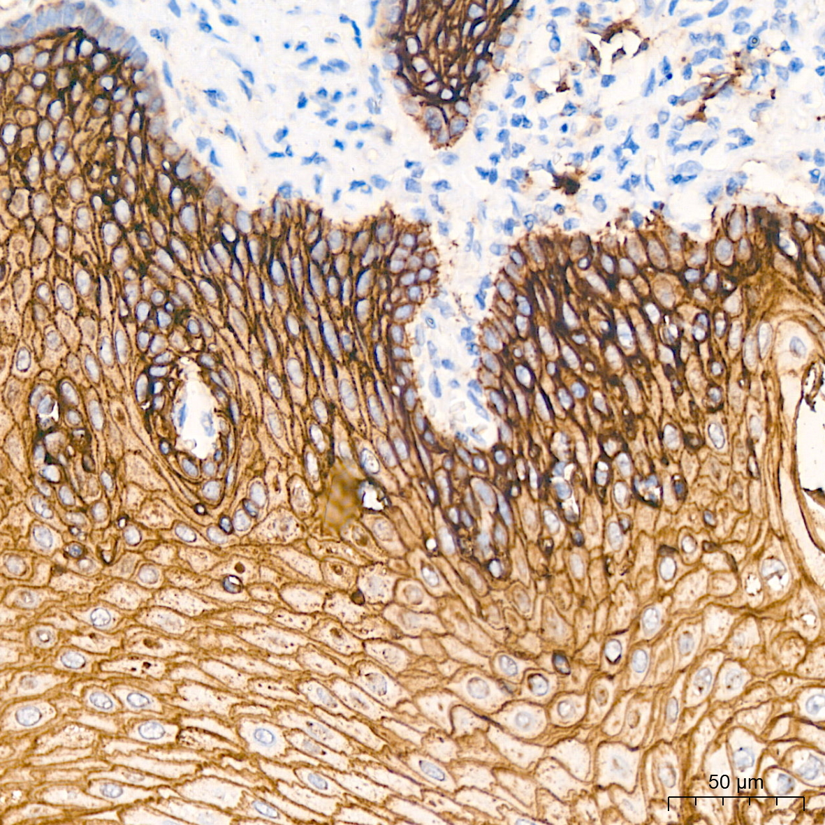 Immunohistochemistry-Paraffin Embeded Fixed Tissue Sample - TROP-2 Rabbit mAb (A20824)