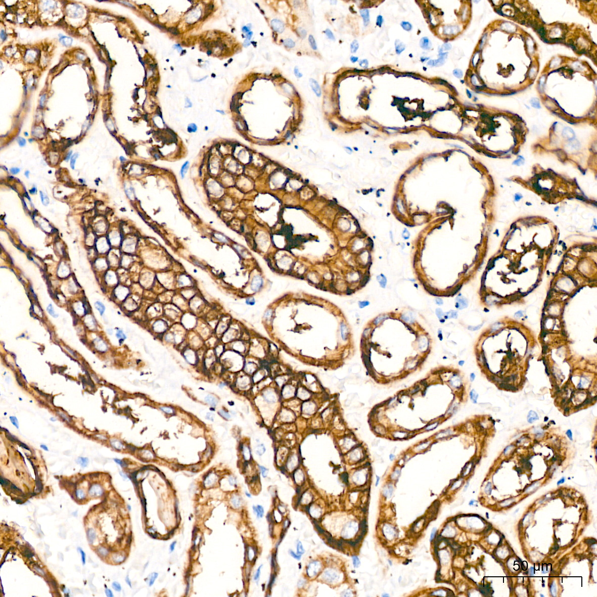 Immunohistochemistry-Paraffin Embeded Fixed Tissue Sample - TROP-2 Rabbit mAb (A20824)