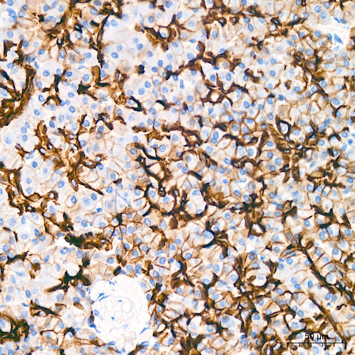 Immunohistochemistry-Paraffin Embeded Fixed Tissue Sample - TROP-2 Rabbit mAb (A20824)