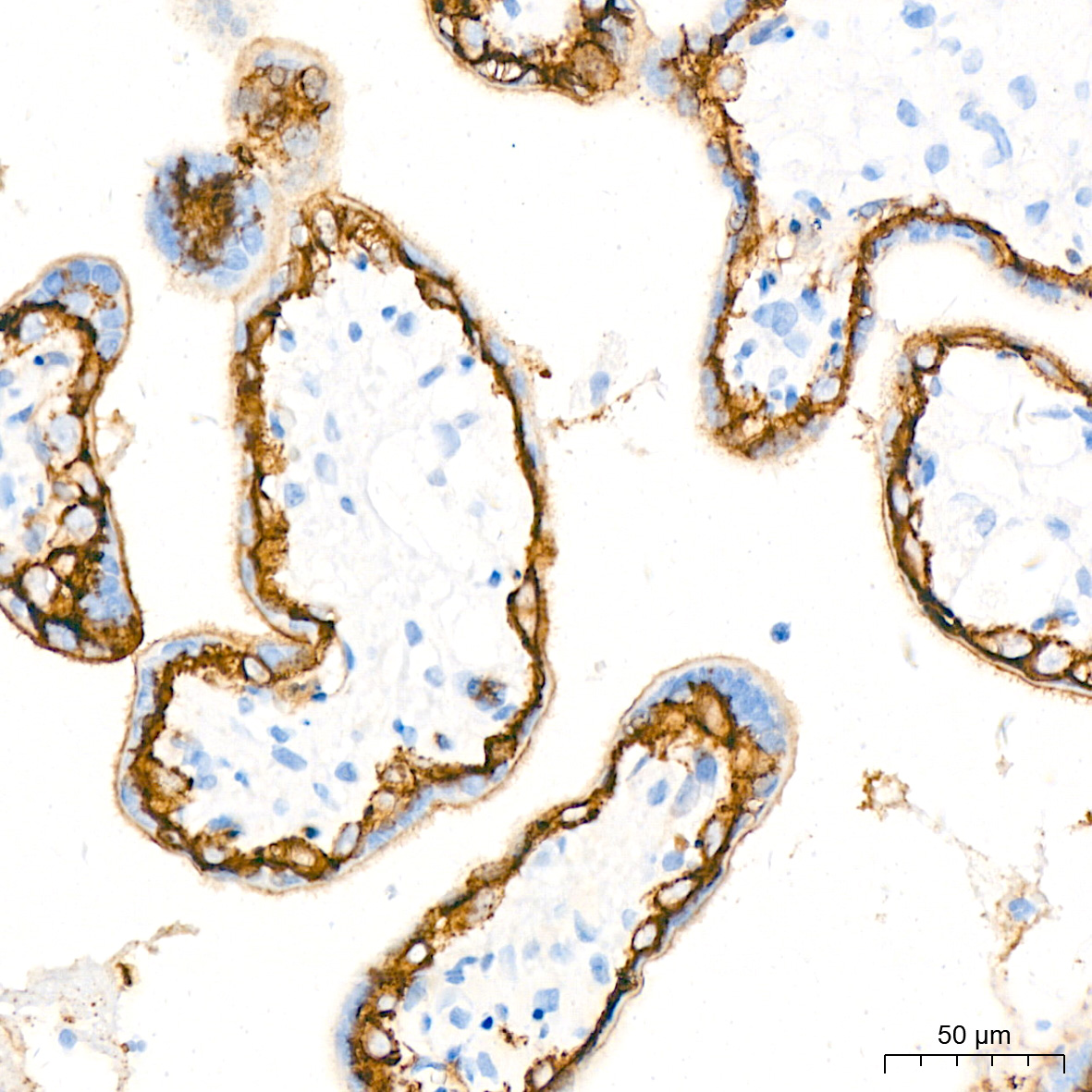 Immunohistochemistry-Paraffin Embeded Fixed Tissue Sample - TROP-2 Rabbit mAb (A20824)