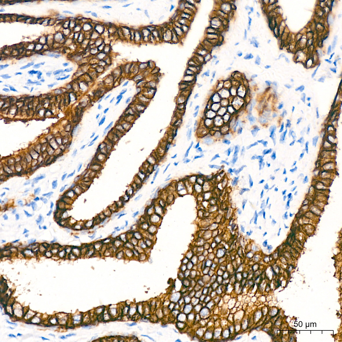 Immunohistochemistry-Paraffin Embeded Fixed Tissue Sample - TROP-2 Rabbit mAb (A20824)