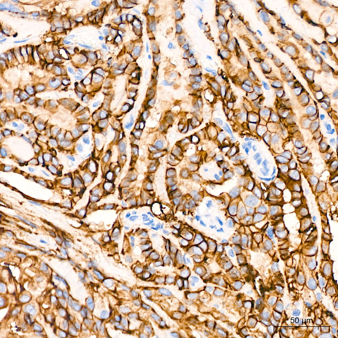 Immunohistochemistry-Paraffin Embeded Fixed Tissue Sample - TROP-2 Rabbit mAb (A20824)