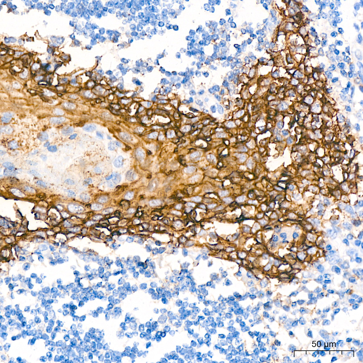 Immunohistochemistry-Paraffin Embeded Fixed Tissue Sample - TROP-2 Rabbit mAb (A20824)