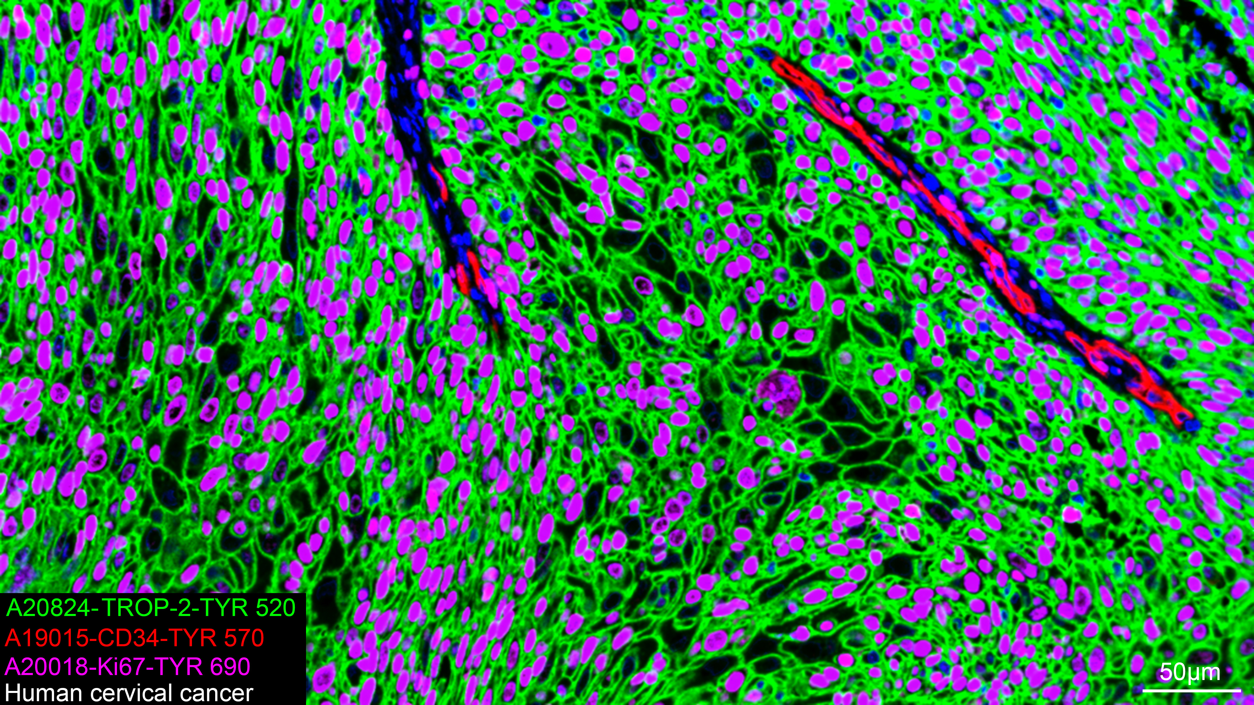 Multiplex Immunohistochemistry - TROP-2 Rabbit mAb (A20824)