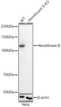 [KO Validated] Hexokinase II Rabbit mAb