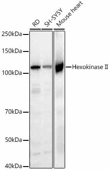 [KO Validated] Hexokinase II Rabbit mAb