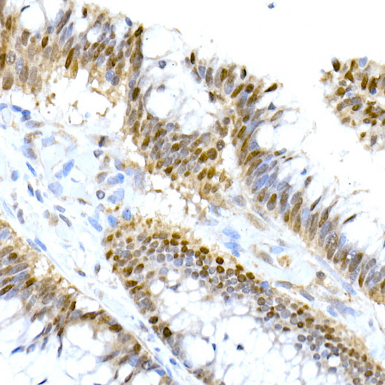 HNF-4-alpha Rabbit mAb