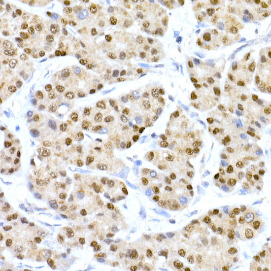 HNF-4-alpha Rabbit mAb