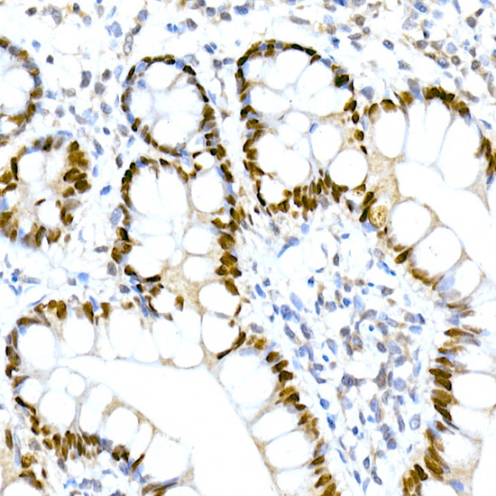 HNF-4-alpha Rabbit mAb