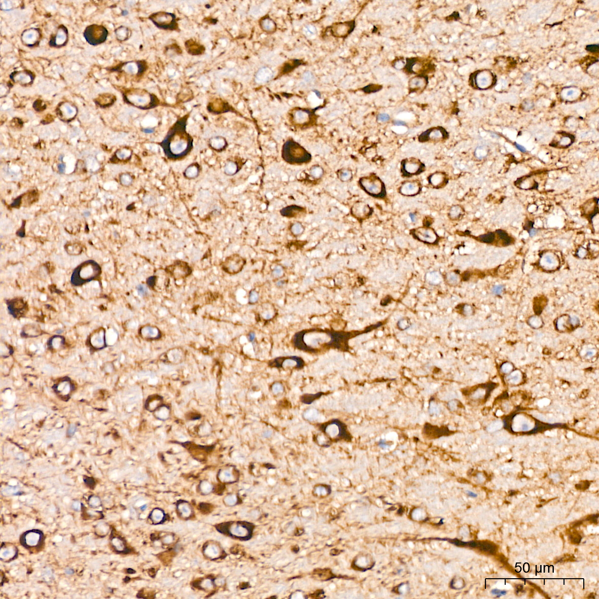 USO1 Rabbit mAb