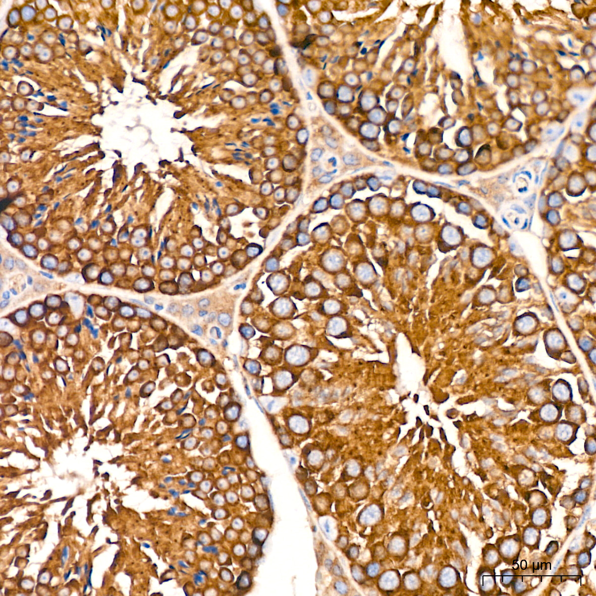 USO1 Rabbit mAb