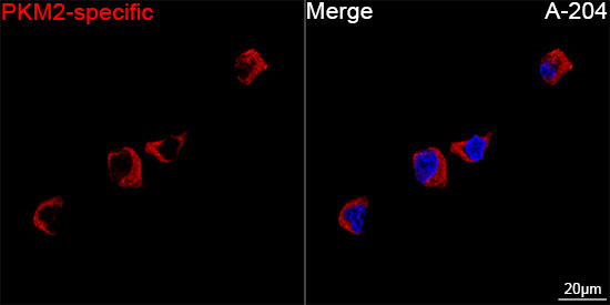 PKM2-specific Rabbit mAb