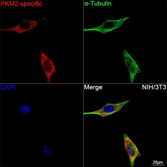 PKM2-specific Rabbit mAb