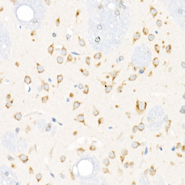 Cation-independent M6PR (IGF2R) Rabbit mAb
