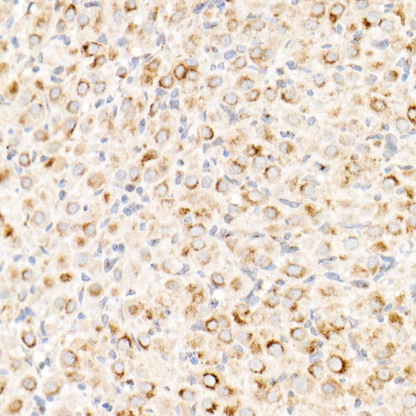 Cation-independent M6PR (IGF2R) Rabbit mAb