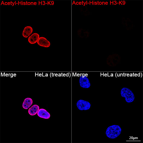 Acetyl-Histone H3-K9 Rabbit mAb
