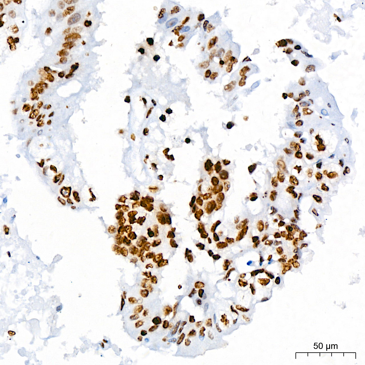 Acetyl-Histone H3-K9 Rabbit mAb